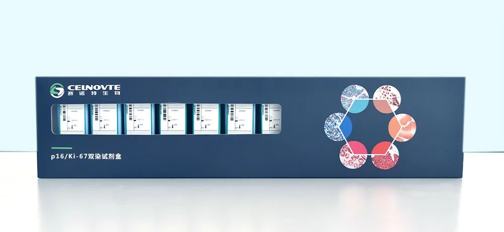 The P16/Ki-67 Dual Staining Detection Kit by Celnovte is a highly advanced diagnostic tool used for the detection of p16 and Ki67 biomarkers on cells or tissue samples.