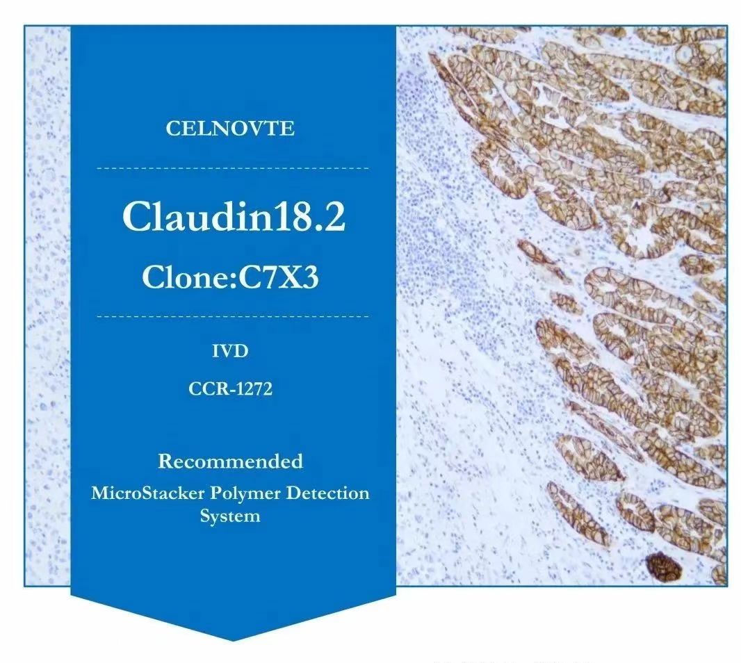 The Claudin 18.2 protein is encoded by the CLDN18 gene, located on chromosome 3q22.3.