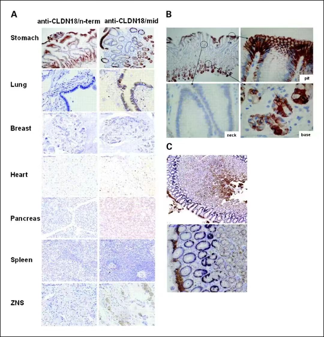 Claudin18.2 protein is a highly selective marker protein that is highly restricted in its expression in normal tissues, with almost no expression. 