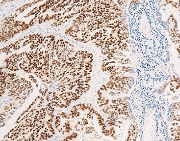 The ER antibody is one of the nearly 80 antibodies developed by the company, and it stands out for its clinical relevance in guiding treatment plans.