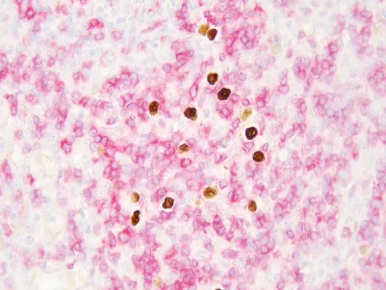 EBERIHC Dual Staining Kit