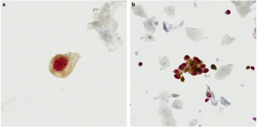 dual staining