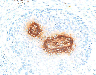 Carcinoembryonic Antigen(CEA),anti-mouse, monoclonal, COL-1