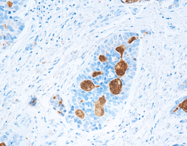 Alpha Fetoprotein (AFP),anti-mouse,monoclonal, C1B1