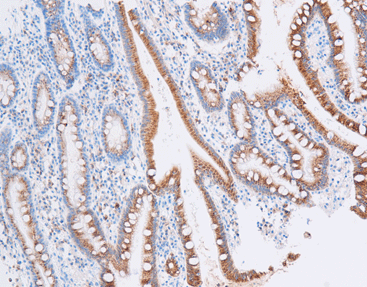 Epithelial Membrane Antigen (EMA),anti-mouse, E29