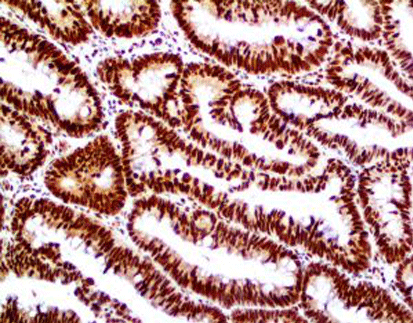 Retinoblastoma Gene Protein (Rb)