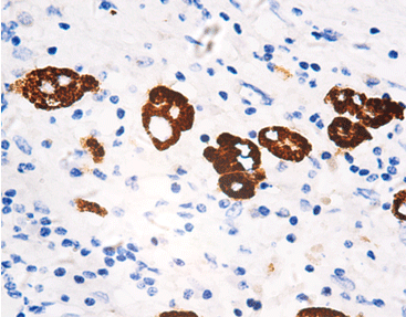 Hepatocyte Specific Antigen (HSA)