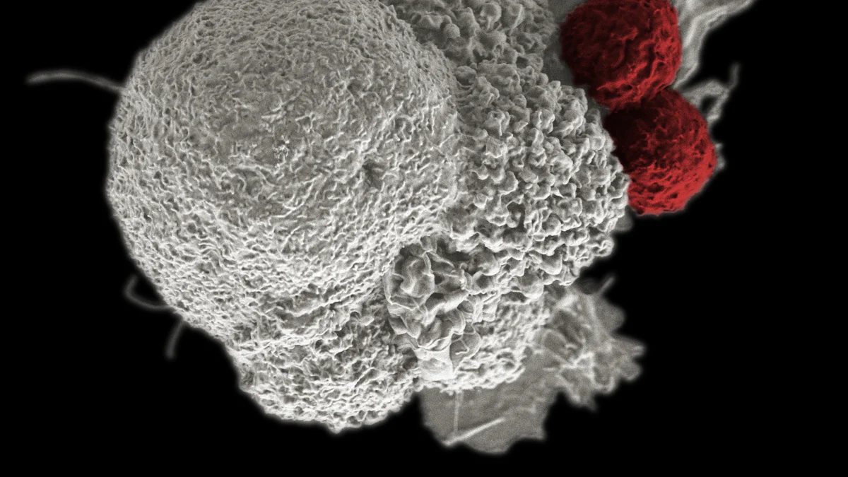 How to Interpret PD-L1 Positive Results in Cancer Diagnosis