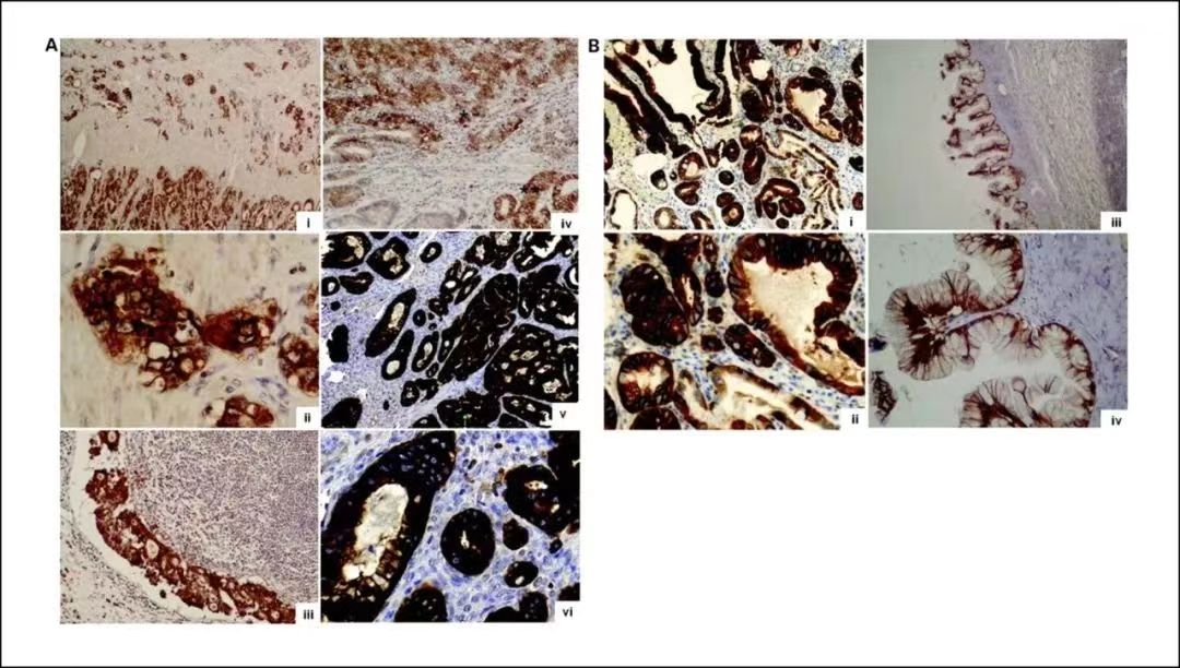 Recommendation of antibodies: 2023 CSCO guidelines add detection target Claudin18.2.