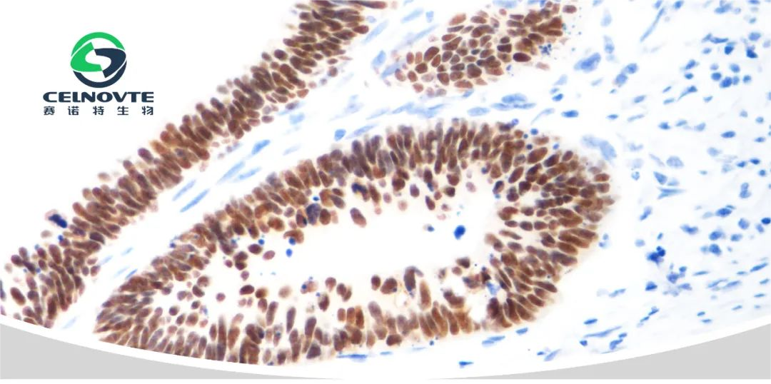 Recommendation of antibodies: TROP2-immunohistochemistry