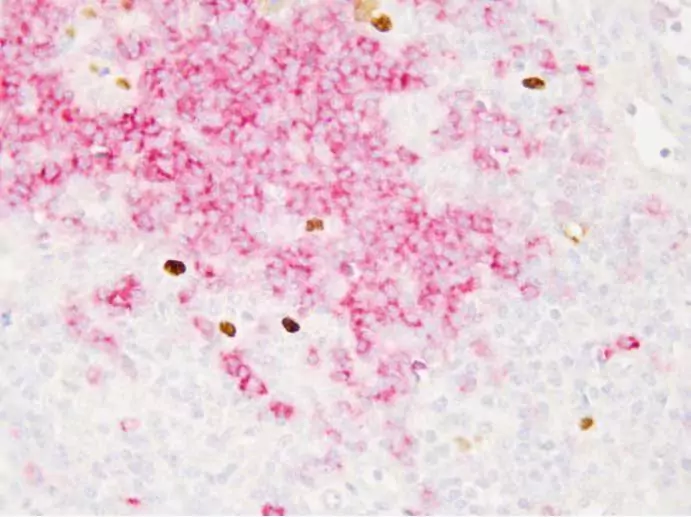 Mastering the EBER Probe for Accurate EBV Identification in Cells