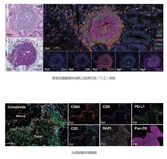 Key Benefits of Multiplex Immunohistochemical Analysis in Research