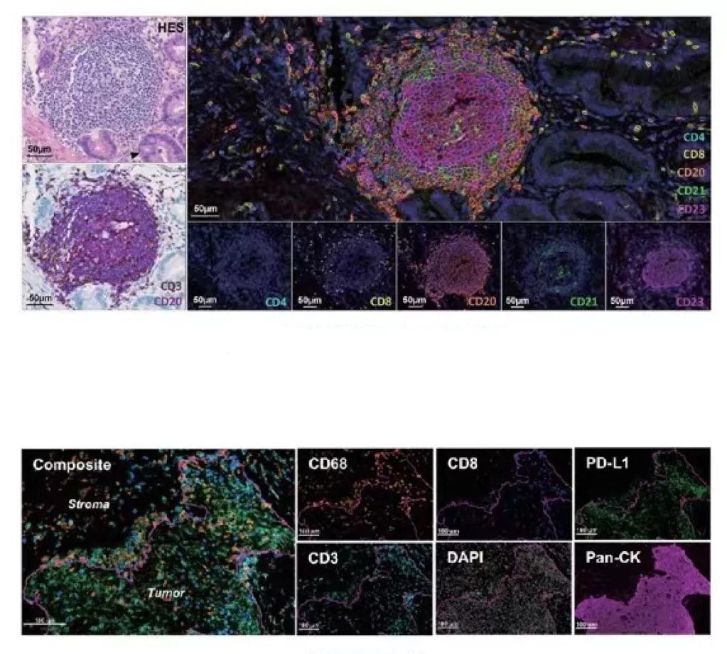 Optimizing mIHC Techniques: Strategies for High Precision Results