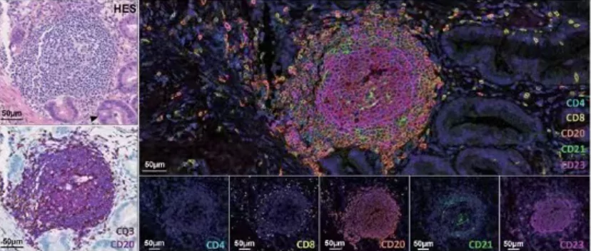 What Are Multiplex Immunohistochemical Kits (mIHC) Used For?