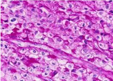 Periodic Acid-Schiff (PAS) Staining: A Histopathology Essential for Detecting Carbohydrates and Beyond