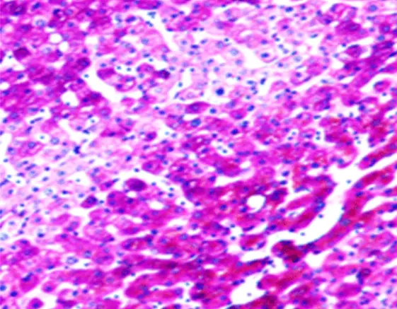 Exploring PAS Staining: Key Applications in Pathological Diagnosis