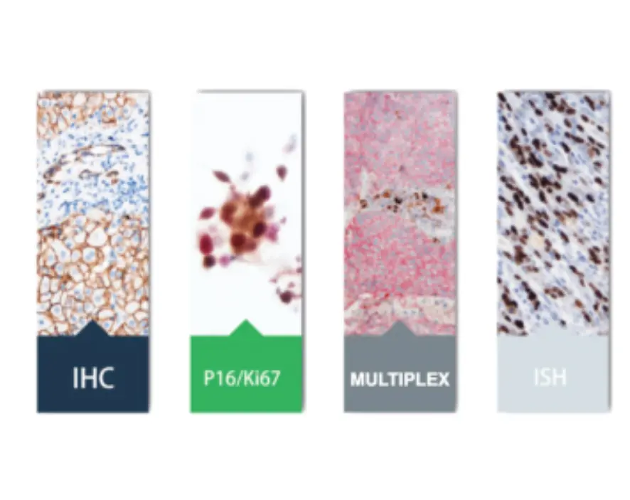 Practical Overview of Multiplex Immunohistochemistry using TSA