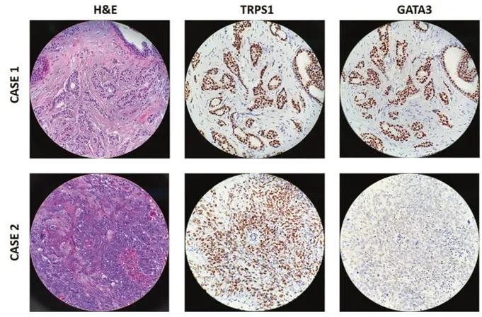 Primary Antibody Selection: Essential Tips for Accurate Results