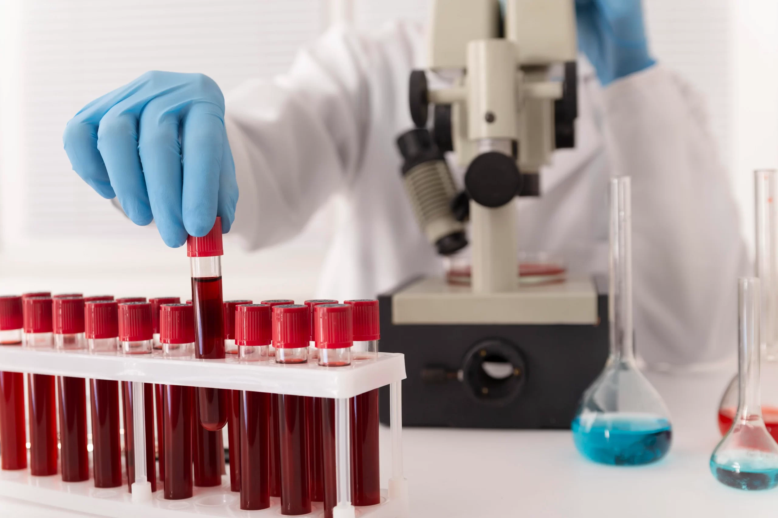 How Kappa and Lambda Light Chains Are Measured in Blood Tests: What You Need to Know